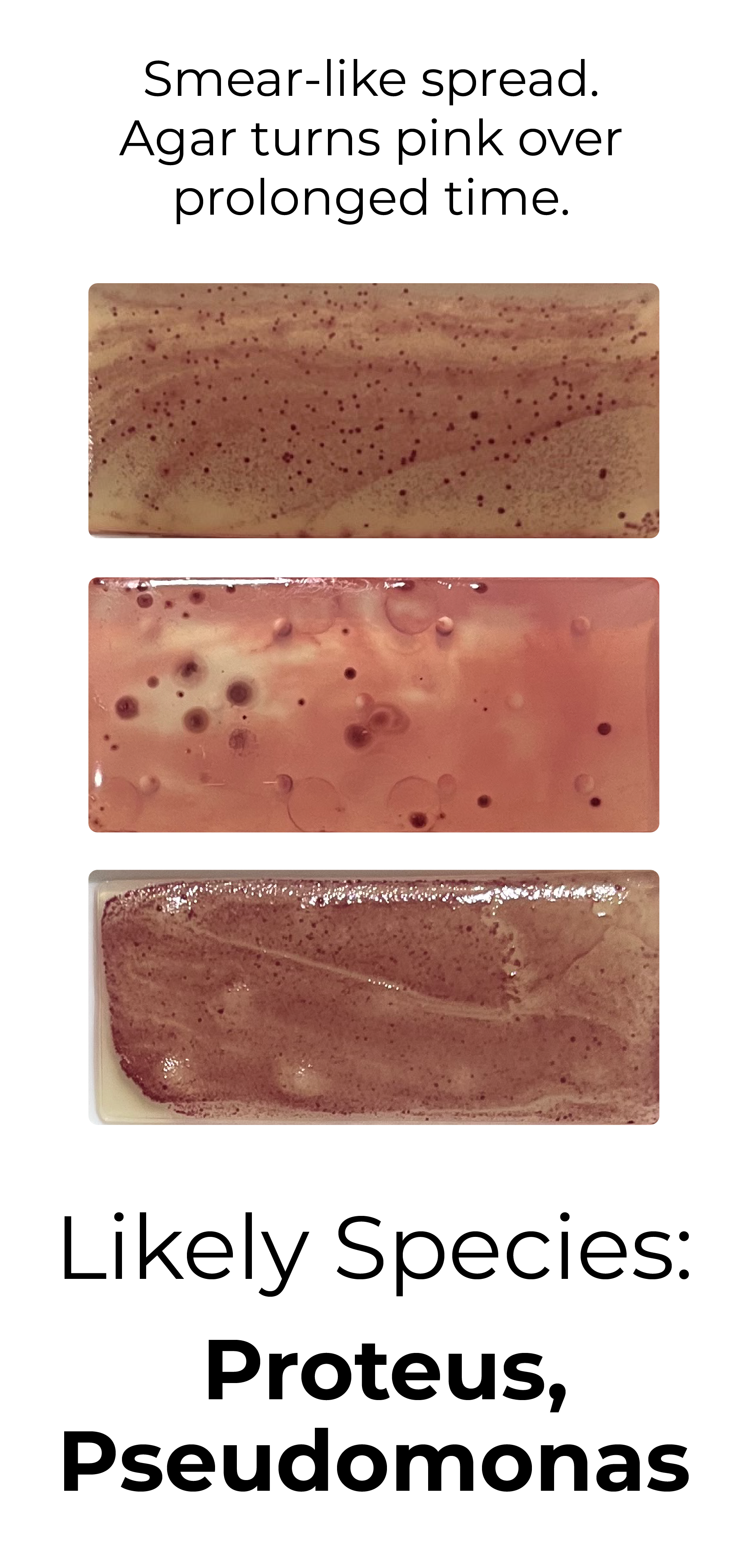 Detekt Rapid Tests