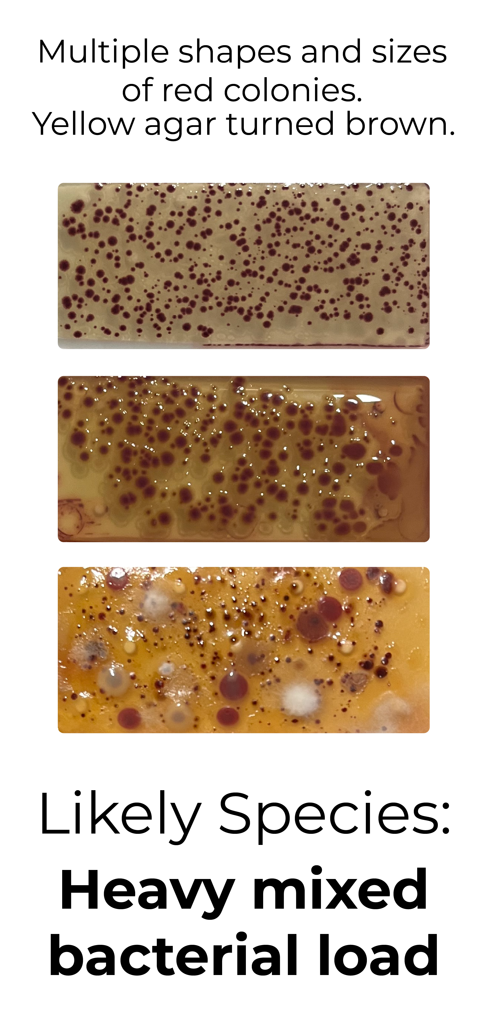 Detekt Rapid Tests