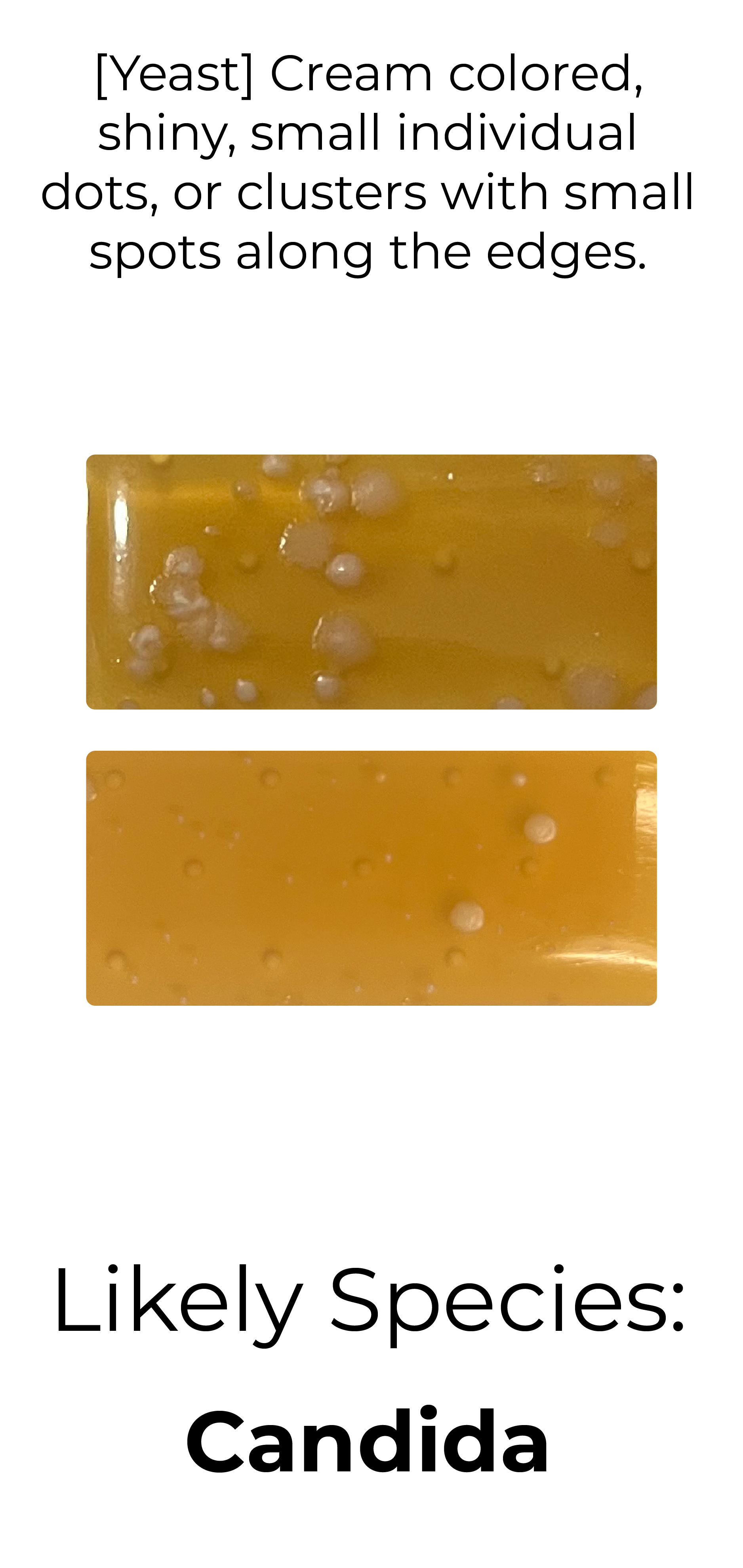 Detekt Rapid Tests