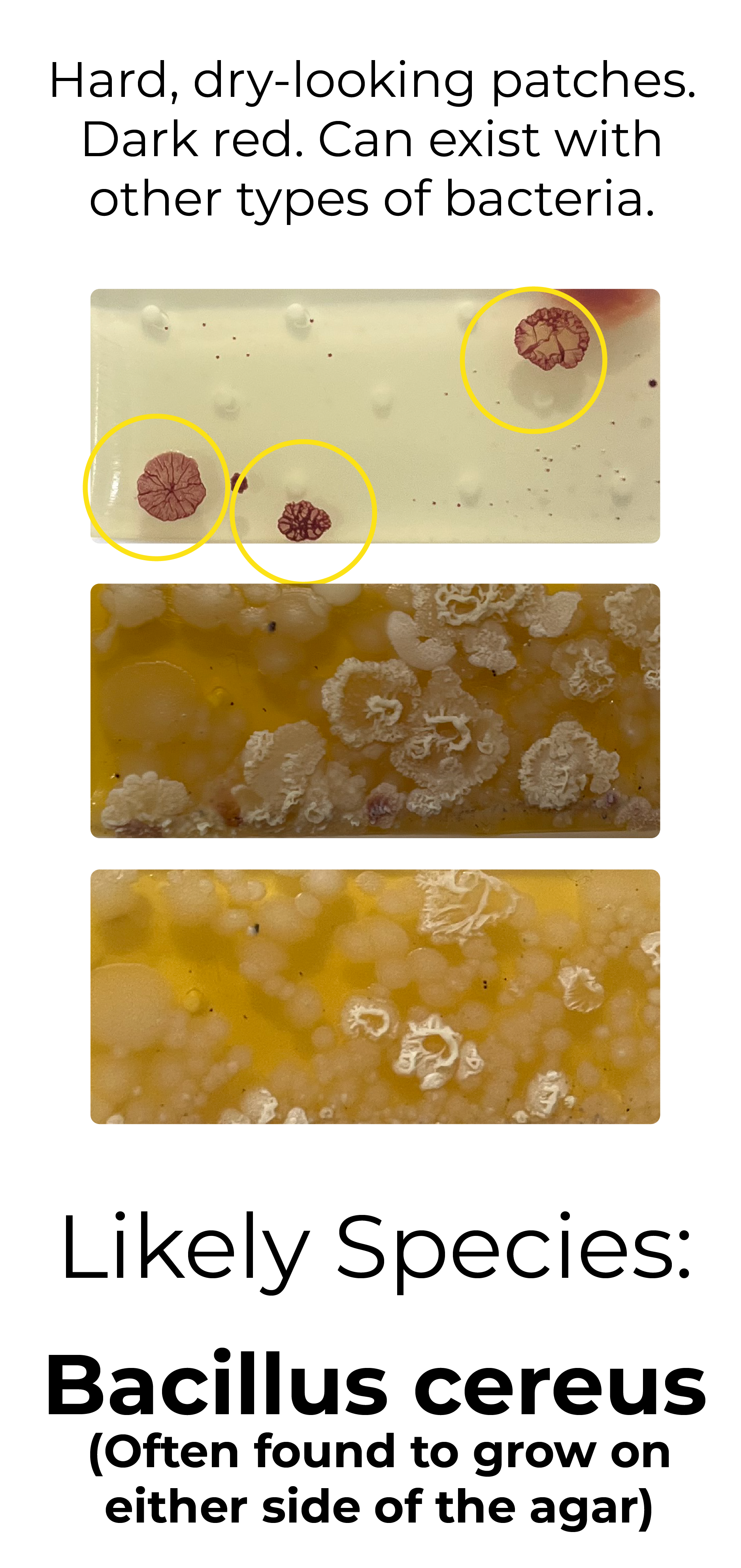 Detekt Rapid Tests